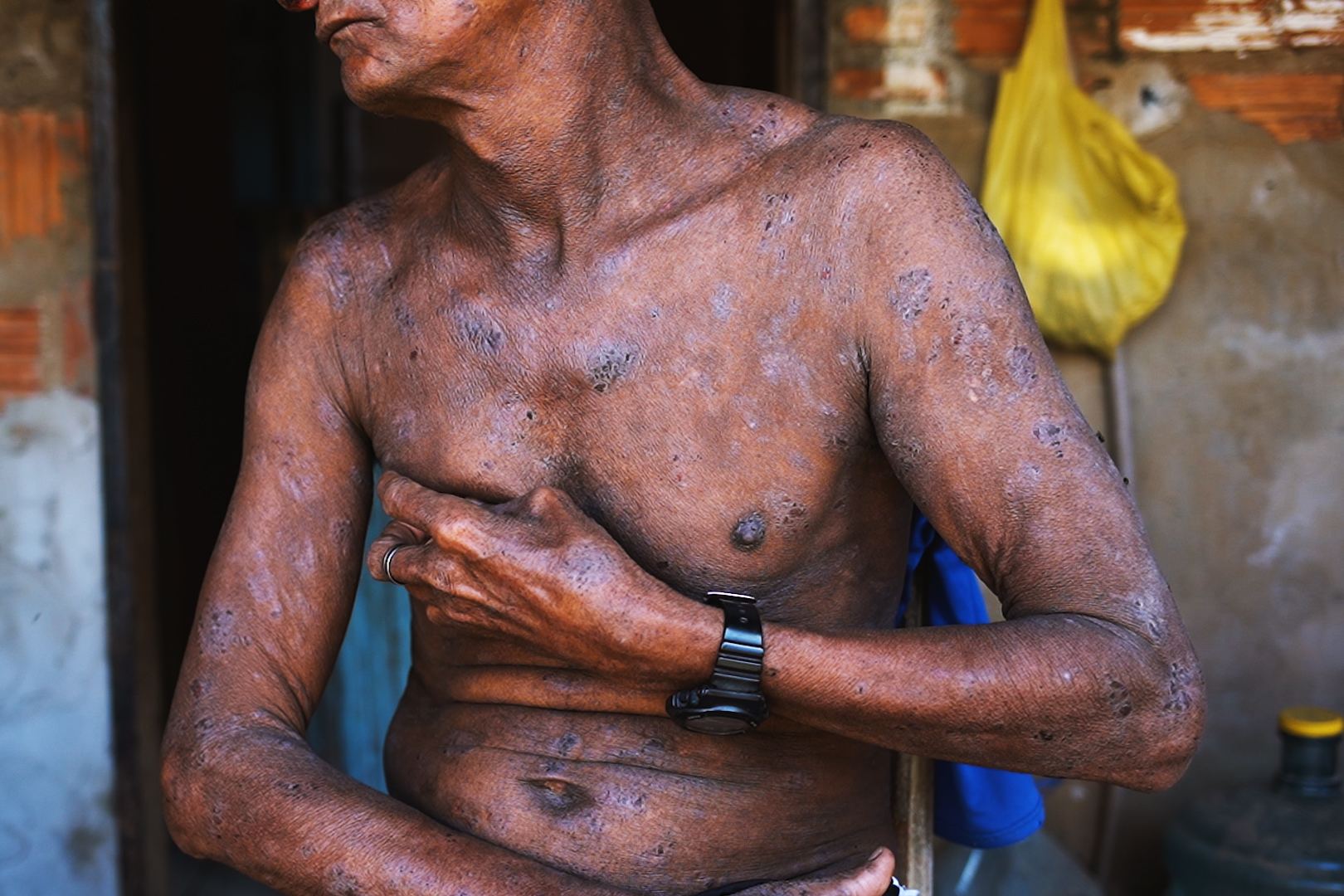 frutas-doces-vidas-amargas-vitor-shimomura-documentario-fotografia